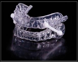 Sleep Apnea Oral Appliance